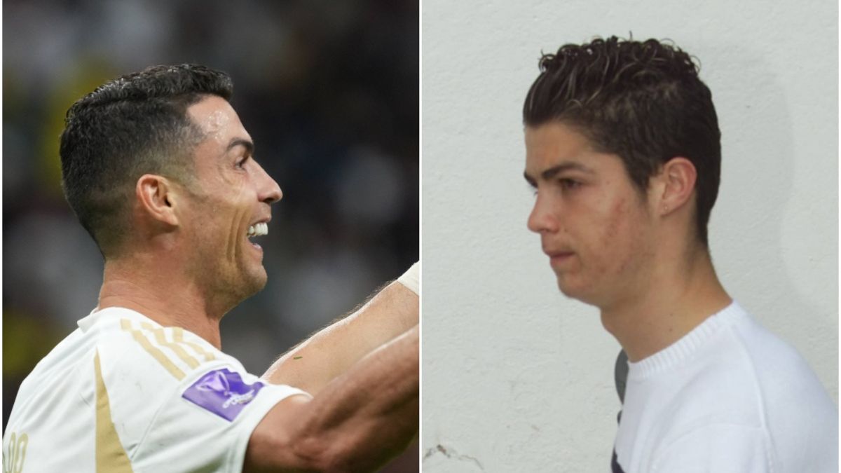 Un chirurg plastician l-a acționat în judecată pe Cristiano Ronaldo! Ce intervenții chirurgicale a avut portughezul și cum s-a transformat de-a lungul anilor
