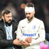 „Moment critic pentru fotbalistul Farului: a ieșit cu capul spart și clavicula fisurată de pe teren – „Mâine va fi operat!””