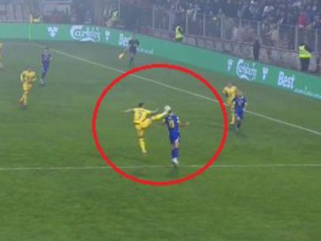 Avem fotografii! Cum arată fruntea lui Nikola Katic după impactul violent primit de la Denis Drăguș