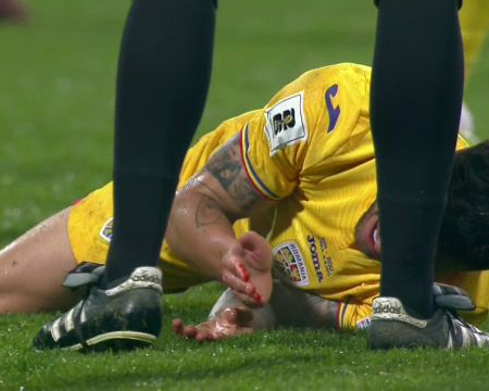 Imagini înfricoșătoare în Bosnia – România! Marius Marin s-a prăbușit pe teren, cu sânge pe el.