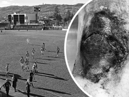 Accident teribil în Liga 2 din România! Jucătorul format de Hagi și-a distrus genunchiul: „Am căzut într-o gură de canal!” » Răspunsul clubului: „Ce canal? Era doar nisip!”